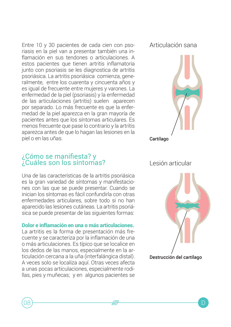 Artritis Psoriásica 2